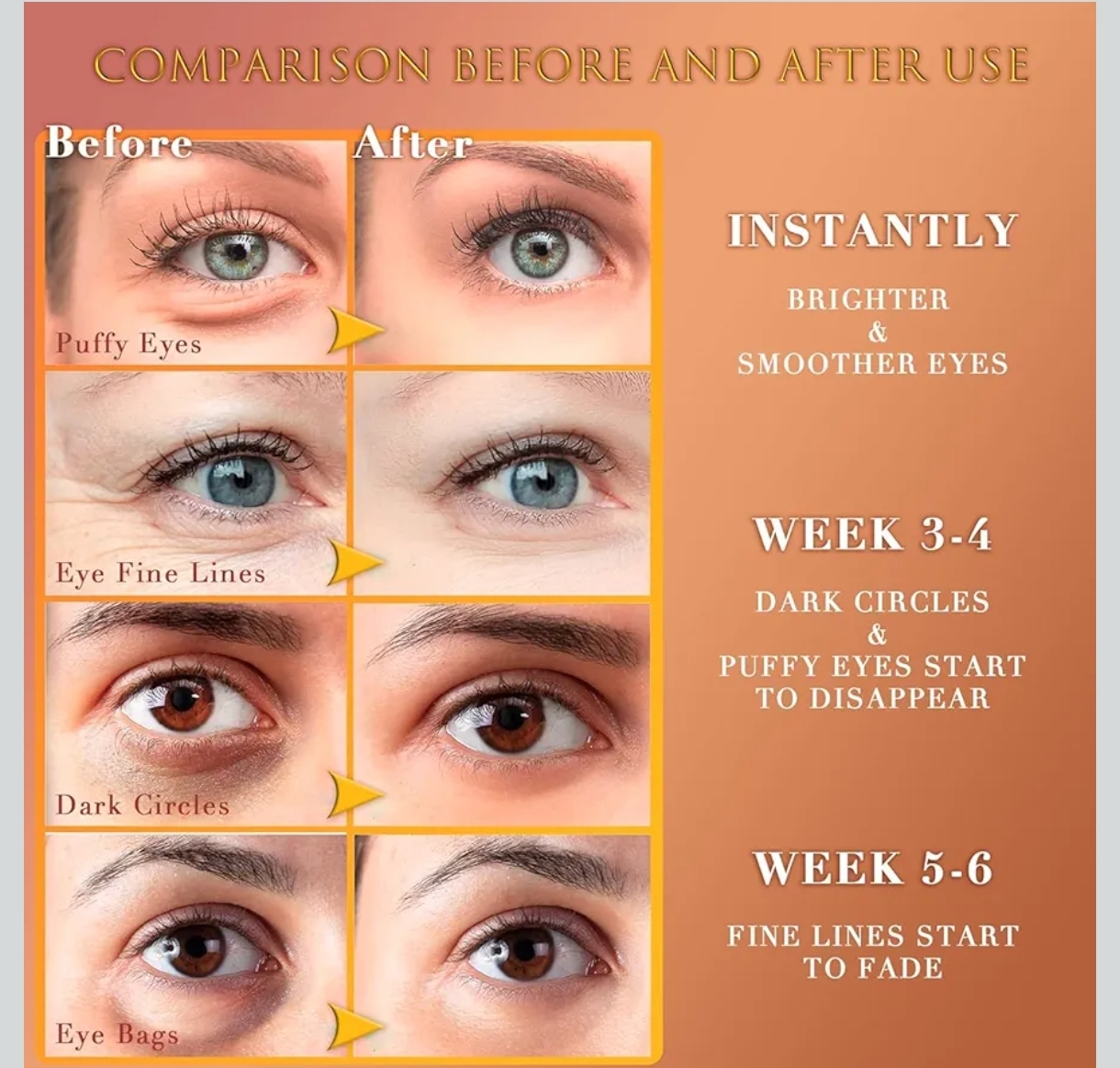 Parche de Ojos Hidrogel Saimyo 24K – Cuidado Premium para tu Mirada - Image 4